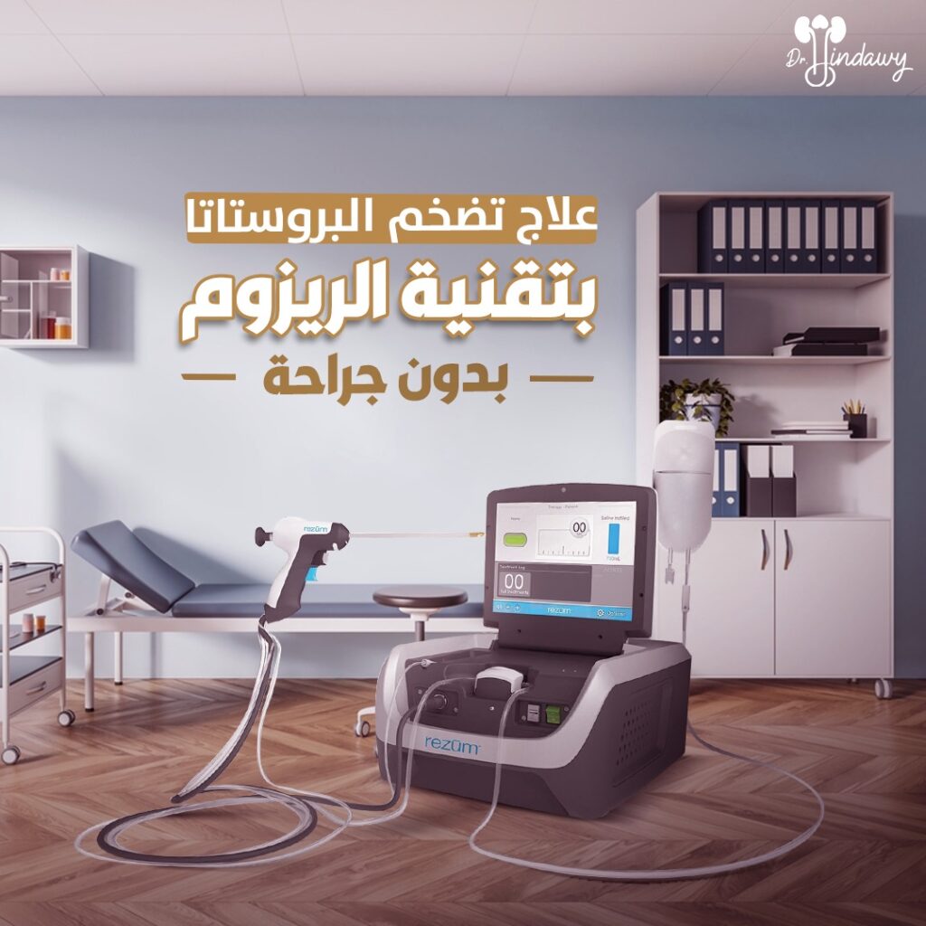 تقنية الريزوم