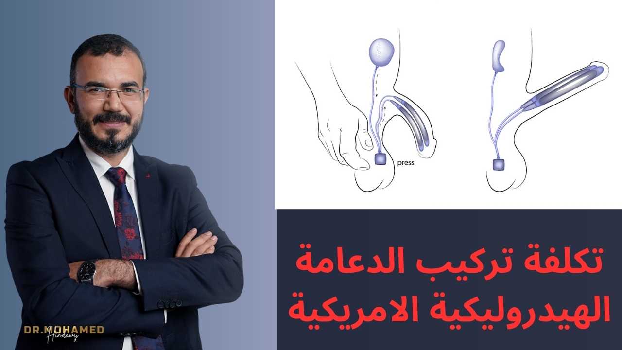 الدعامة الهيدروليكية الامريكية