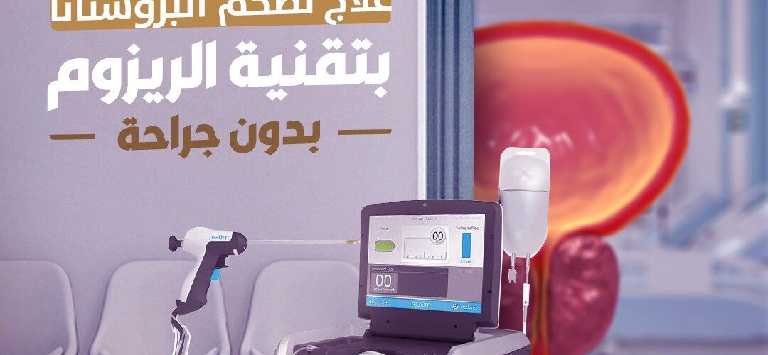 علاج تضخم البروستاتا بالتبخير